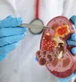 Kidney Disease