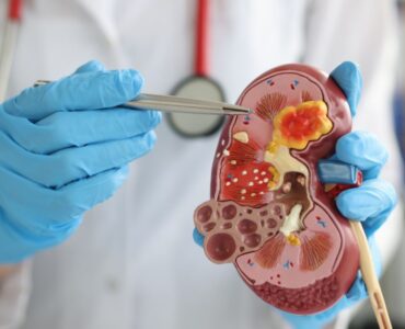 Kidney Disease