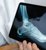 X- ray