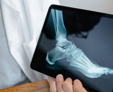 X- ray