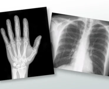 bestxray lab