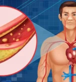 lipidtest