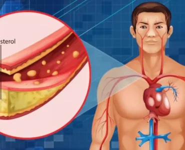 lipidtest