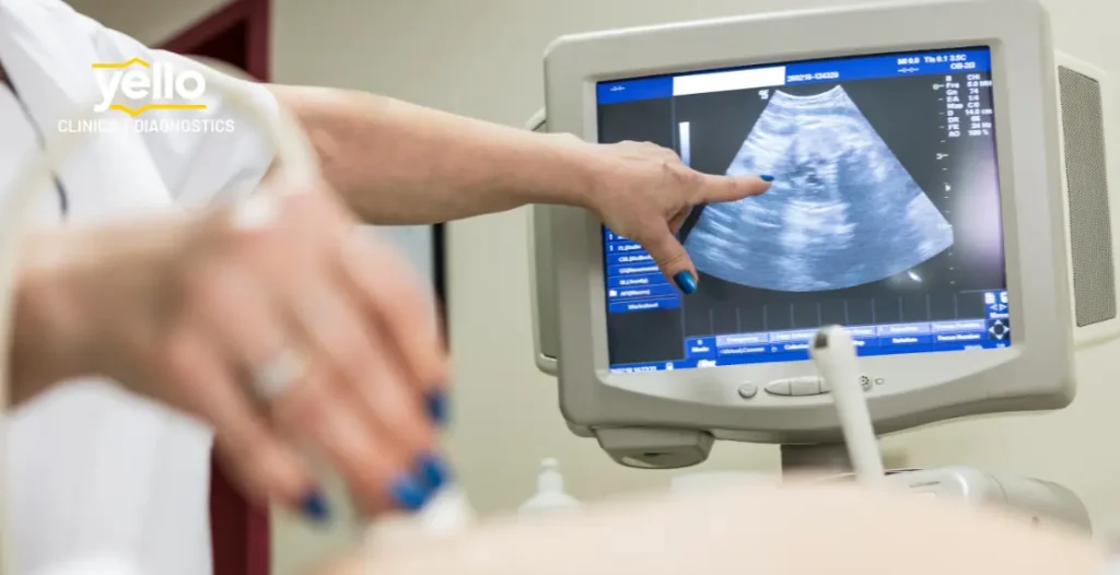 What Does Doppler Ultrasound Monitor in the Baby