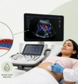Color Doppler Ultrasound