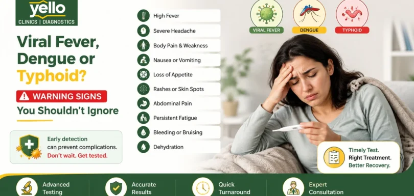 viral fever symptoms