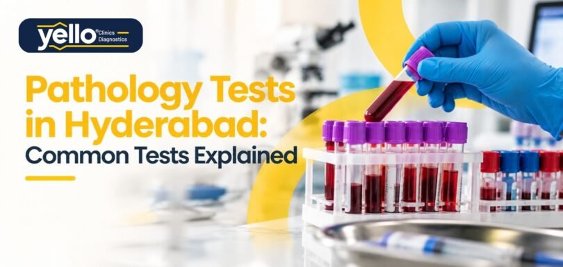 Pathology Tests in Hyderabad: Common Tests Explained